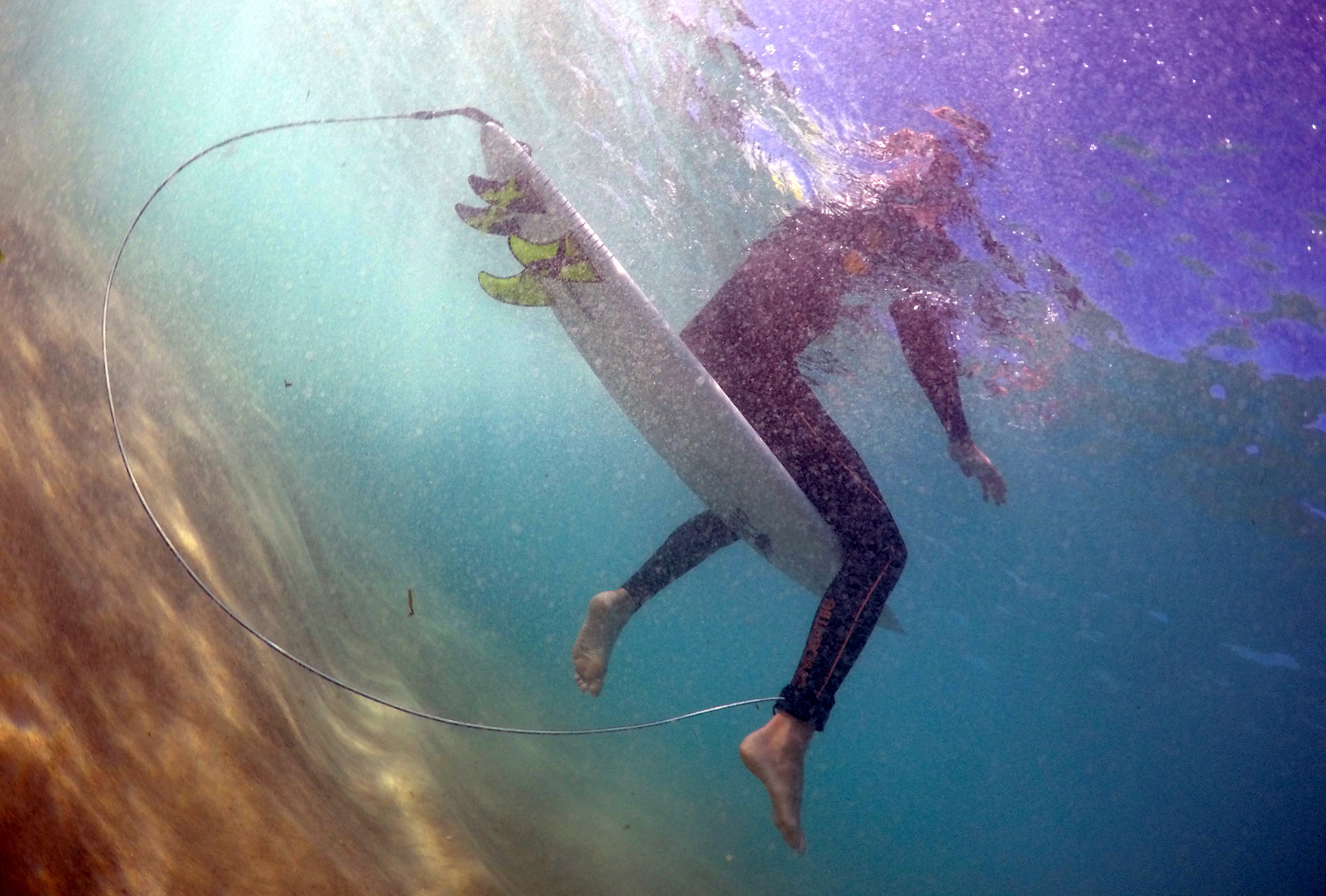 Surfer Macpherson sits on his board, which has an electronic shark repellent device installed, at Sydney's Bondi Beach in Australia